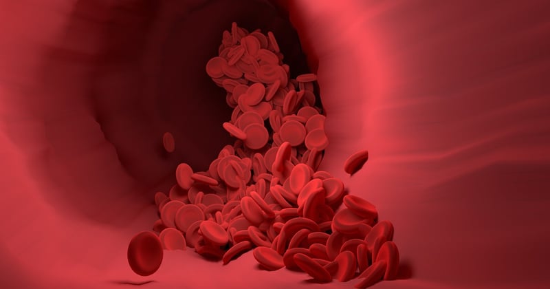 L’impression 3D révolutionne la fabrication de dispositifs médicaux personnalisés